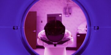 اسکن‌ MRI باعث تشکیل مواد مضر در داخل بدن می‌شود