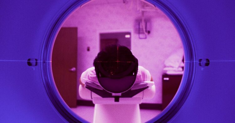 اسکن‌ MRI باعث تشکیل مواد مضر در داخل بدن می‌شود