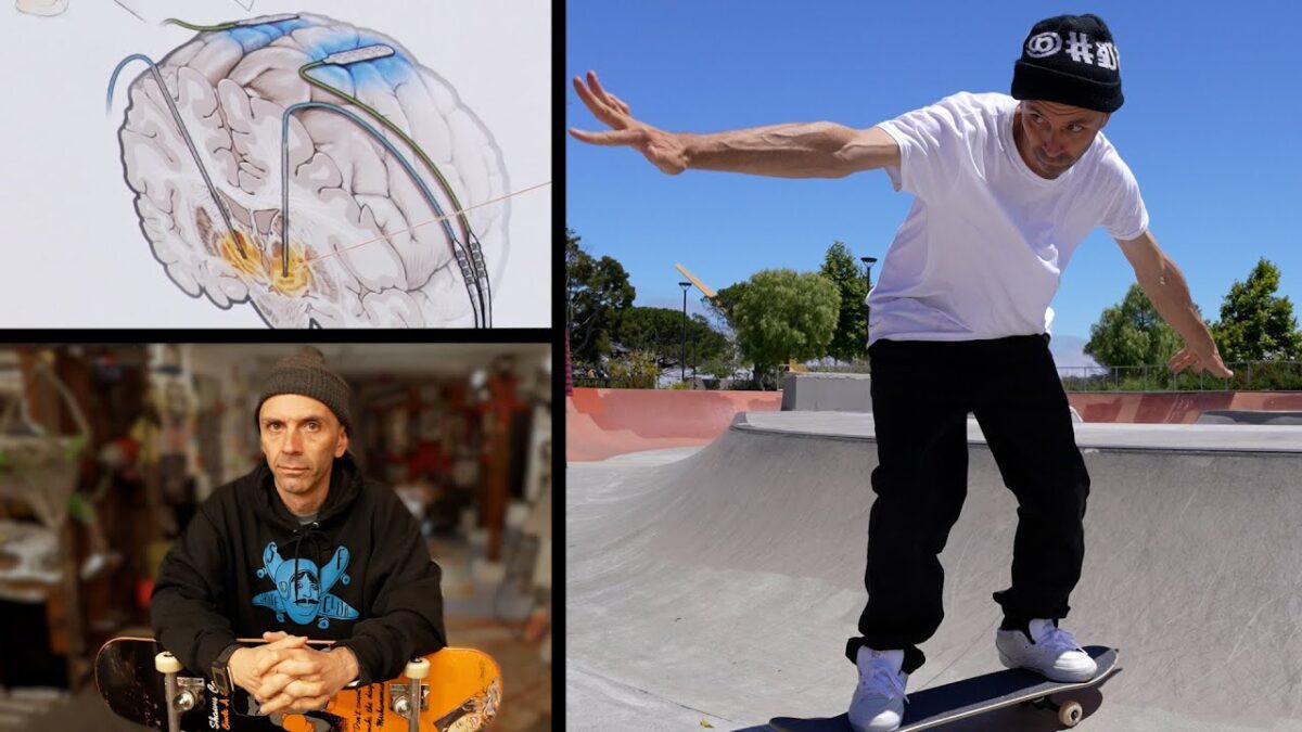 انقلاب در درمان پارکینسون با سیستم‌های هوشمند تحریک مغز