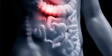 فیبر محلول یک سد دفاعی در روده برای مقابله با عفونت‌های خطرناک