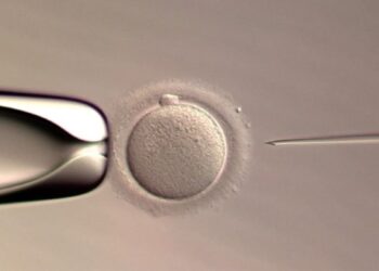 تولد اولین نوزاد حاصل از تزریق اسپرم با هوش مصنوعی