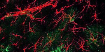 این مولکول می تواند کاهش عملکرد مغزی ناشی از سالمندی و آلزایمر را بهبود بخشد