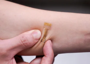 پانسمان هوشمند iCares عفونت را قبل از وقوع تشخیص می دهد