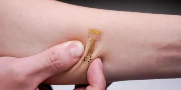 پانسمان هوشمند iCares عفونت را قبل از وقوع تشخیص می دهد