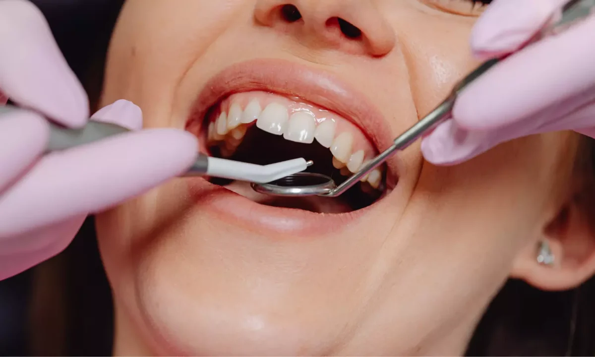 شدت عفونت مزمن ریشه دندان با ترکیب ورزش و امگا ۳ کاهش می یابد