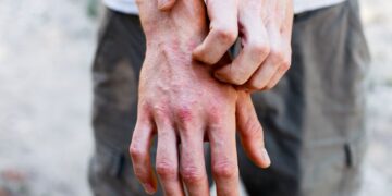 ر آزمایش‌ های انسانی