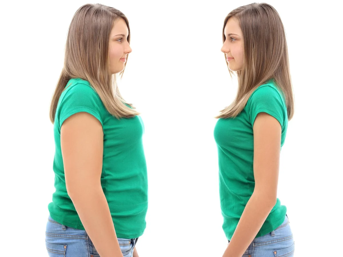 اغلب افراد پس از جراحی کاهش وزن، بهبود در سلامت روان خود تجربه میکنند