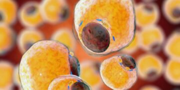 کشف پروتئین سرکوبگر چربی قهوه‌ ای برای درمان لاغری ناشی از سرطان