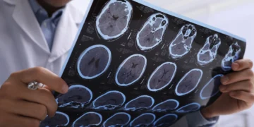 آیا بازیابی عملکرد سلول ‌های مغزی می‌ تواند کلید درمان بیماری ام‌ اس باشد؟