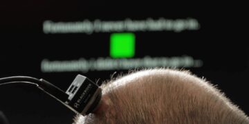 بازگشت گفتار بیمار ALS با فناوری ایمپلنت مغزی