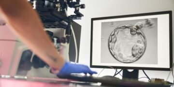 بارداری موفق پس از ۱۸ سال با شناسایی اسپرم پنهان به کمک هوش مصنوعی