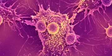 واکسن سرطان با قابلیت درمان انواع سرطان وارد مرحله آزمایش انسانی شد