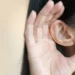 موفقیت قابل‌ توجه ژن‌درمانی پیشرفته جدید در درمان ناشنوایی