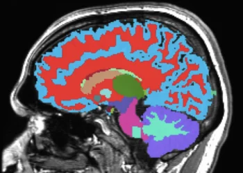 پیشبینی خطر زوال عقل و بیماری های مزمن میانسالی با یک اسکن مغزی جدید