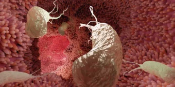 ۷۵ درصد موارد سرطان معده با یک درمان ساده قابل پیشگیری است