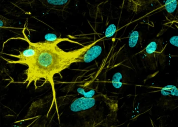 تولید ۴۰۰ نوع سلول عصبی مختلف از سلول ‌های بنیادی برای درمان بیماری های عصبی