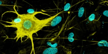 تولید ۴۰۰ نوع سلول عصبی مختلف از سلول ‌های بنیادی برای درمان بیماری های عصبی