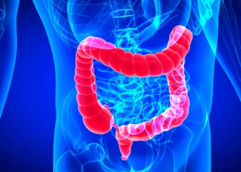 ۵ راه ساده برای کاهش خطر ابتلا به بیماری دیورتیکولیت در سنین بالا