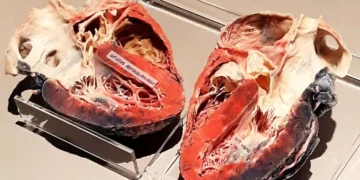 کشف روشی جدید برای شفاف سازی مغز و قلب در تصویربرداری سه بعدی