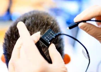 بازگشت تکلم بیمار فلج پس از ۱۸ سال با رابط مغز-رایانه مجهز به هوش مصنوعی