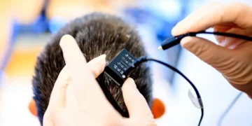 بازگشت تکلم بیمار فلج پس از ۱۸ سال با رابط مغز-رایانه مجهز به هوش مصنوعی