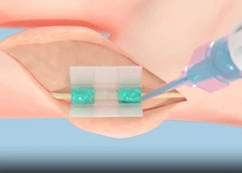 پلیمر زیست‌سازگار MIT جایگزین بخیه در جراحی‌ ها شد