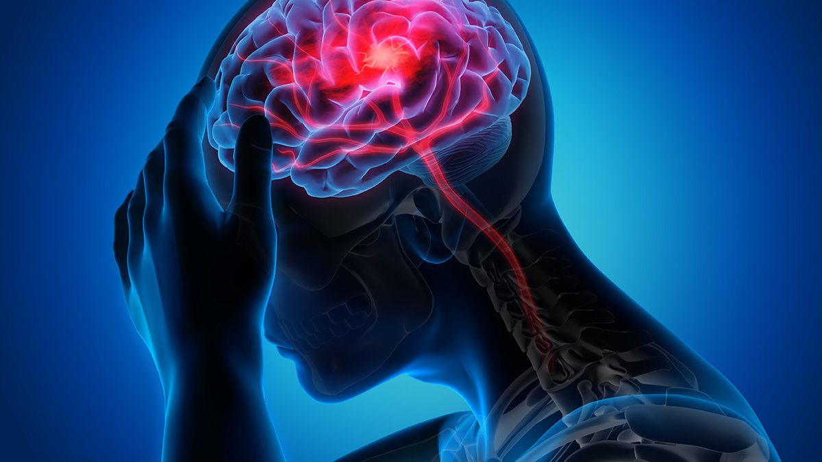 تشخیص سریع و دقیق سکته مغزی با این مدل هوش مصنوعی جدید
