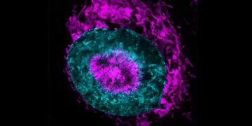 کشف توانایی پنهان سلول‌های سرطانی در مواجهه با فشار فیزیکی
