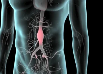 یک ترکیب شیمیایی مضر در گوشت قرمز خطر آنوریسم آئورت شکمی را سه برابر می‌ کند