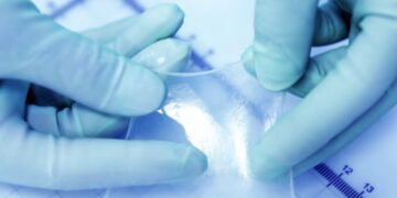 این پانسمان زیستی ایرانی به سرعت باعث ترمیم زخم می شود