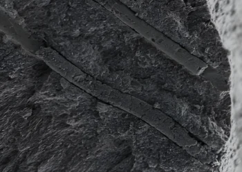 درمان دائمی حساسیت دندانی با نانوربات‌ های هوشمند