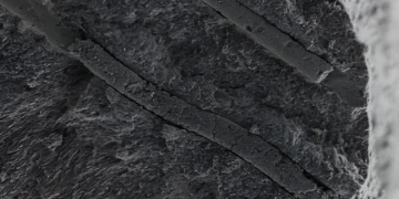 درمان دائمی حساسیت دندانی با نانوربات های هوشمند