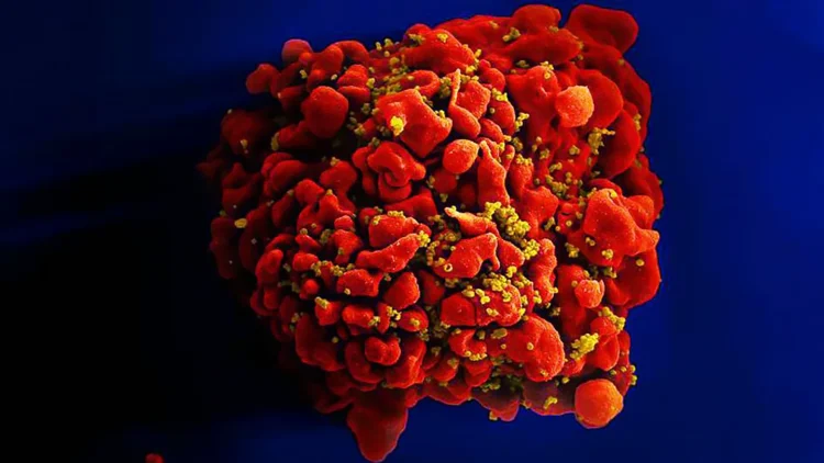 کشف نقطه ‌ضعف کلیدی ویروس HIV که راه را برای درمان بهتر هموار می کند