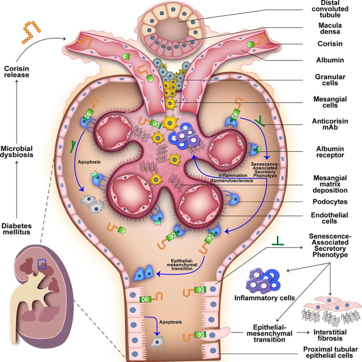 راهی جدید برای جلوگیری از آسیب کلیوی در بیماران دیابتی کشف شد