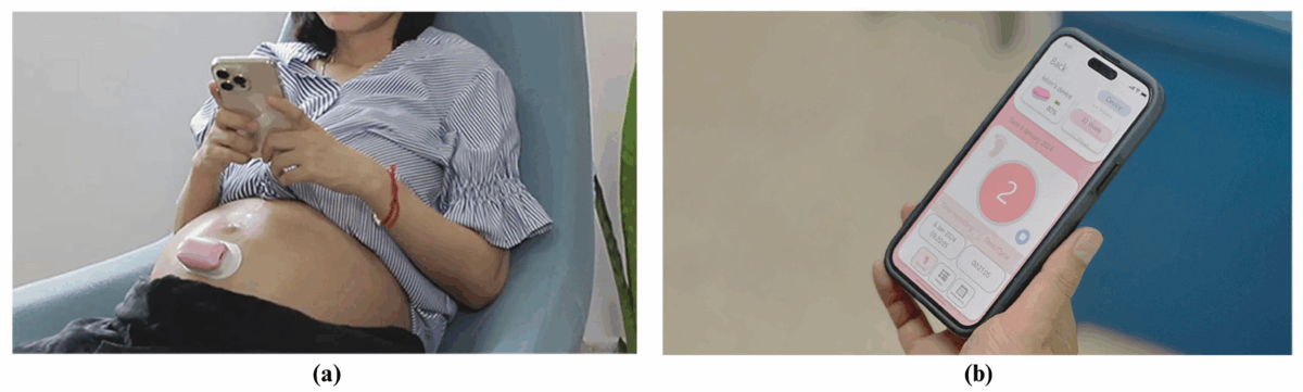 استفاده از گجت های پوشیدنی هوشمند برای نظارت دقیق بر بارداری