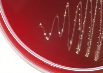 باکتریهای دهانی می توانند عامل حملات قلبی باشند