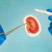 آغاز نخستین آزمایش گسترده پیوند کلیه خوک به انسان با چراغ سبز FDA