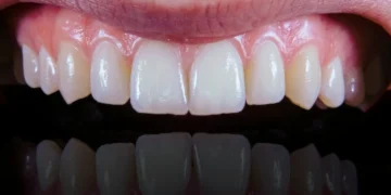 نقش چشمگیر رژیم مدیترانه‌ای در پیشگیری از بیماری‌ های لثه