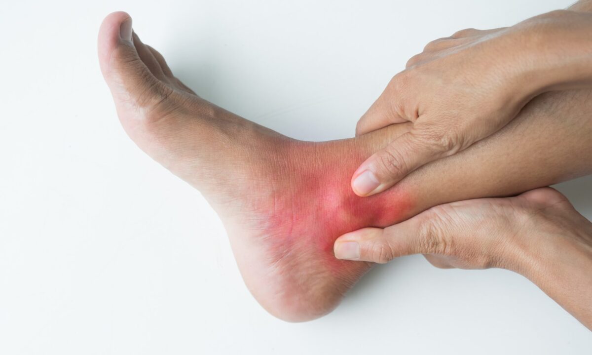 پیری زودرس سیستم ایمنی می ‌تواند پیش ‌بینی ‌کننده روماتیسم مفصلی در مراحل ابتدایی باشند