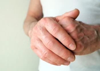 پیری زودرس سیستم ایمنی، پیش بینی کننده روماتیسم مفصلی در مراحل اولیه است