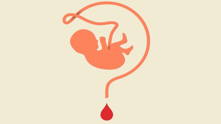 ذخیره ۲۵۰ هزار نمونه خون بندناف در ایران