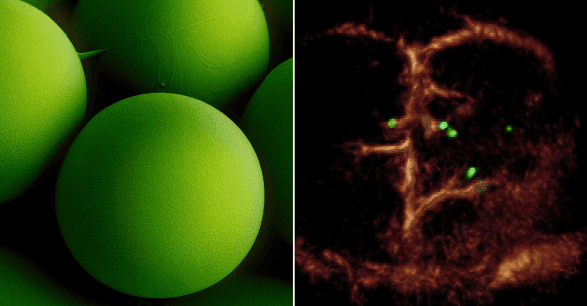 میکرورباتهای مغناطیسی