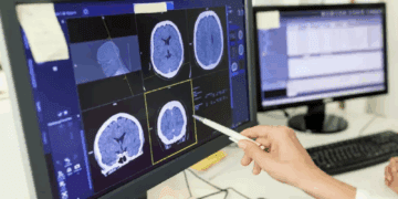 کنترل تشنج با ترکیب امواج صوتی و ژن‌درمانی