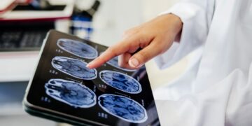 تایمرهای مولکولی