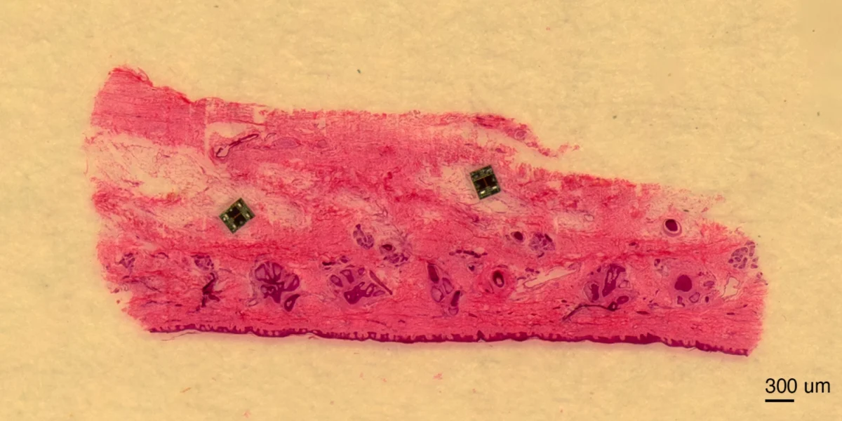 برش بافت زیستی زیر میکروسکوپ با حضور دو ربات میکروسکوپی الکترونیکی که امکان تعامل این ربات‌ها با بافت زنده را نمایش می‌دهد