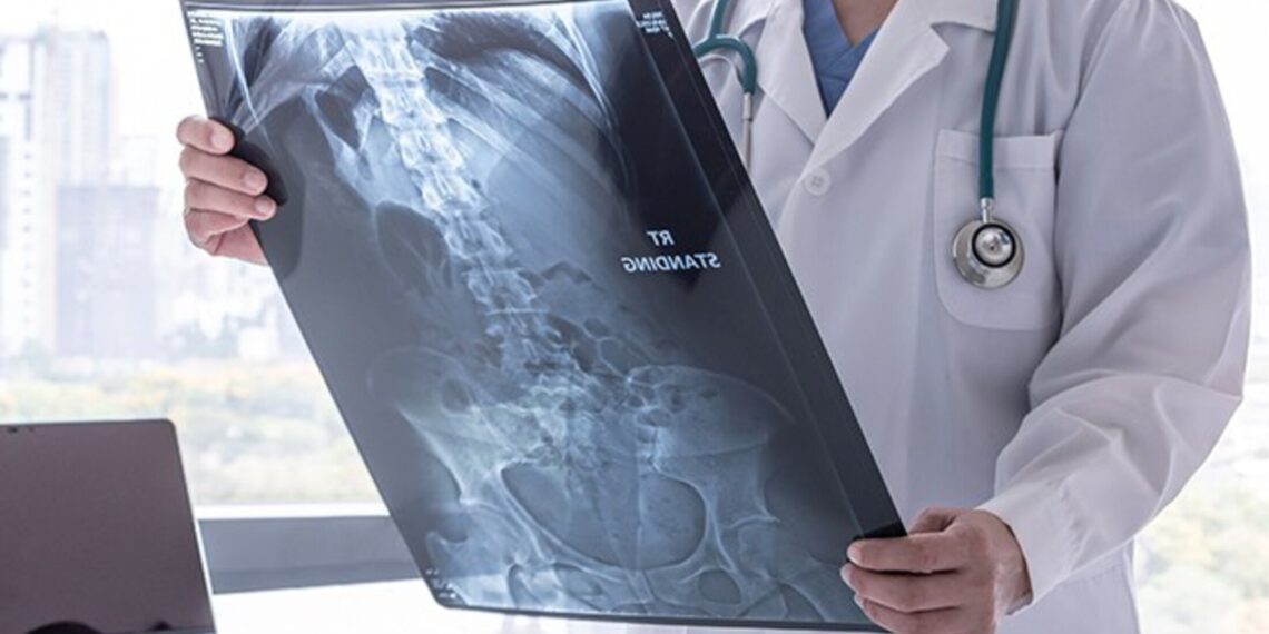 نانومواد مغناطیسی و امید تازه برای درمان سرطان استخوان