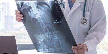 نانومواد مغناطیسی و امید تازه برای درمان سرطان استخوان