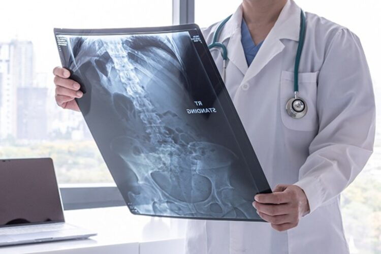 نانومواد مغناطیسی و امید تازه برای درمان سرطان استخوان