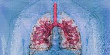 نخستین پیوند موفق ریه از فرد HIV مثبت به بیمار HIV مثبت در جهان