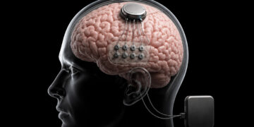چین اولین سامانه MRI جهان را برای خواندن مغز ساخت